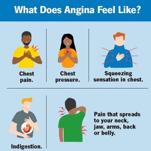 angina