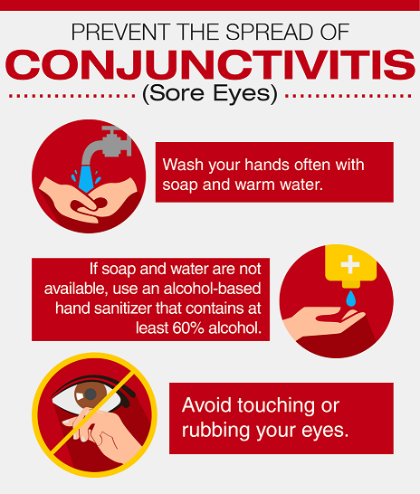 conjunctivitis prevention