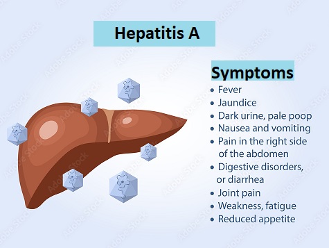 hepatitis A, symptoms of hepatitis A, viral hepatitis