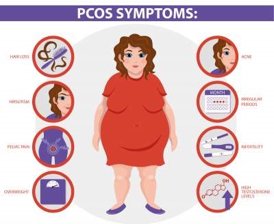 polycystic ovarian syndrome , PCOS , symptoms,