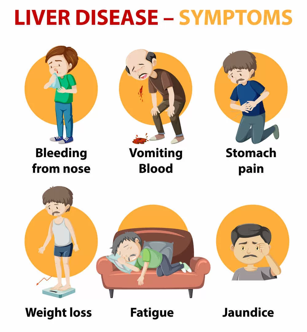 symptoms of obstructive jaundice