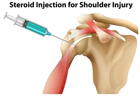 corticosteroids, intraarticular corticosteroid injection