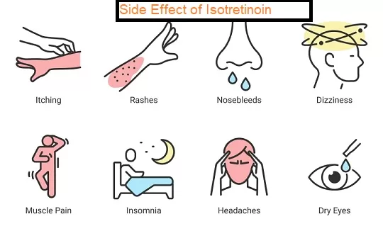 side effect of isotretinoin, isotretinoin 