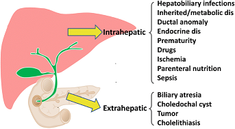 Causes of obstructive jaundice 