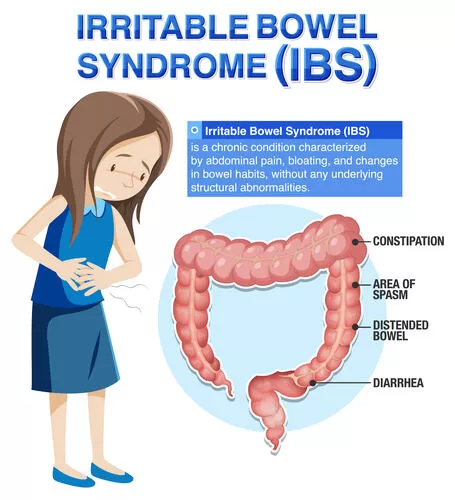 symptoms of irritable bowel syndrome, irritable bowel syndrome