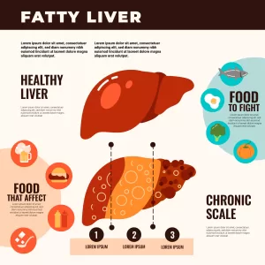 causes of fatty liver disease