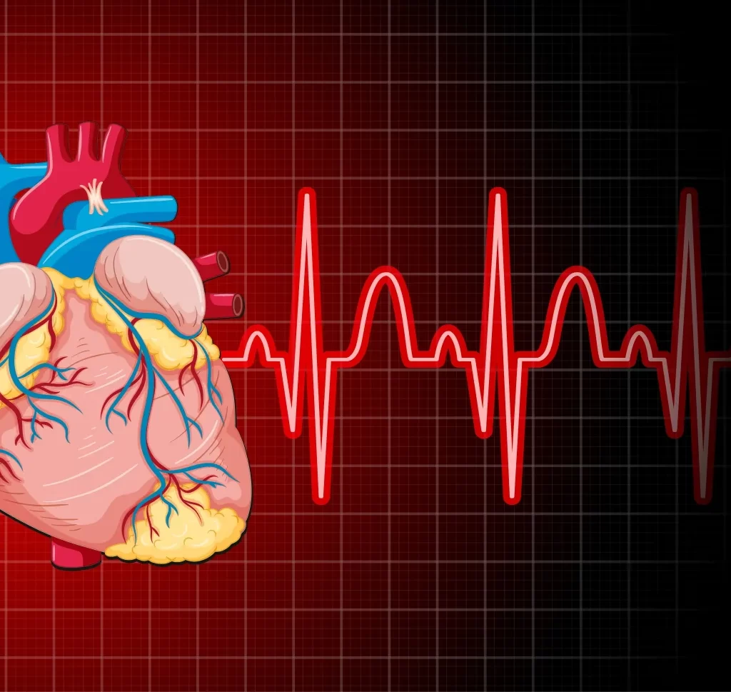 crt, Cardiac Resynchronization therapy