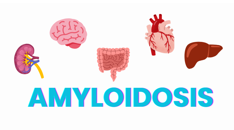 AMYLOIDOSIS