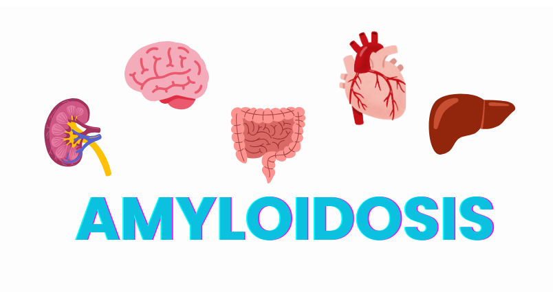 AMYLOIDOSIS