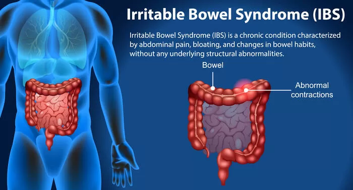 irritable bowel syndrome