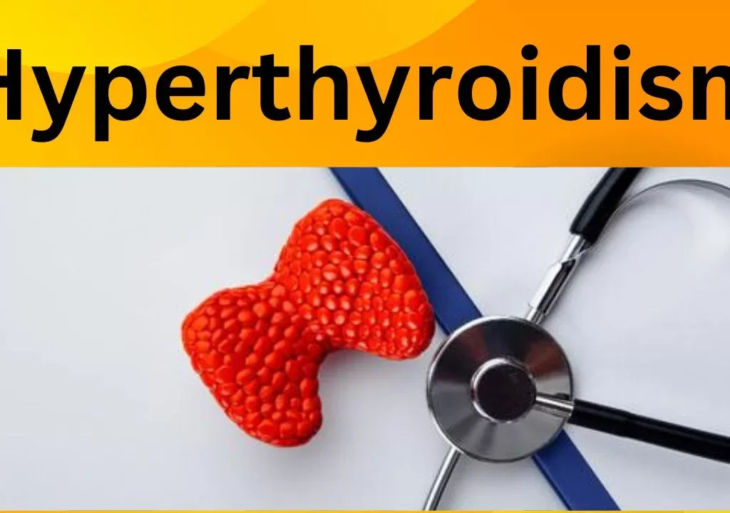 hyperthyroidism