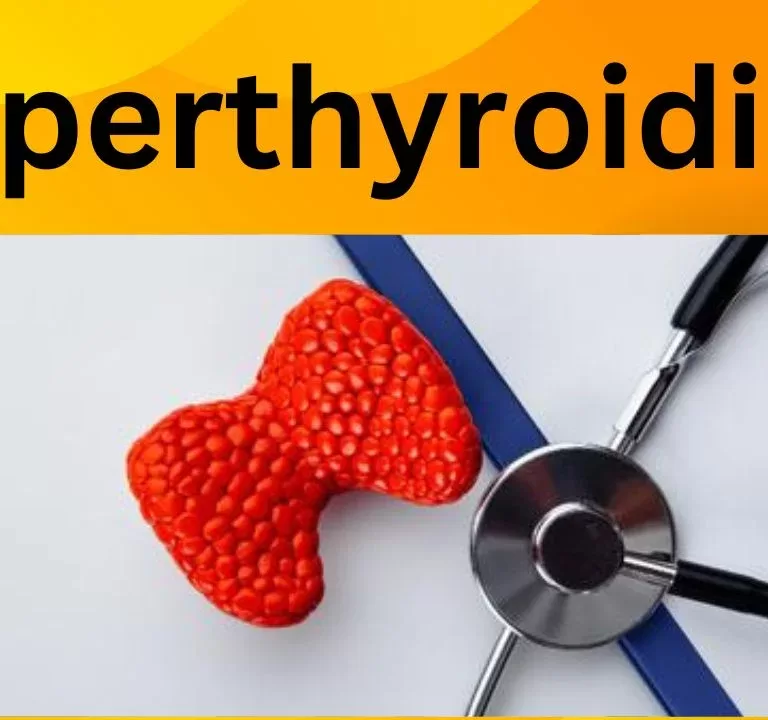 hyperthyroidism