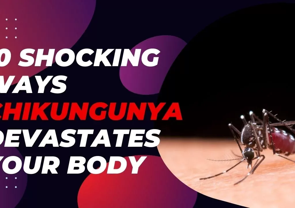 chikungunya