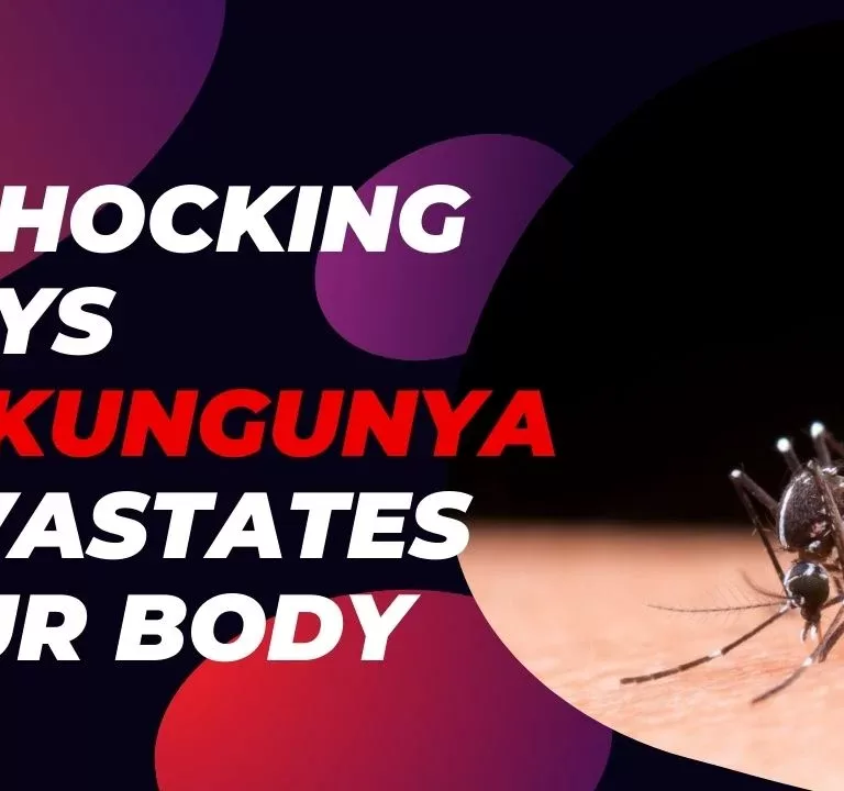 chikungunya